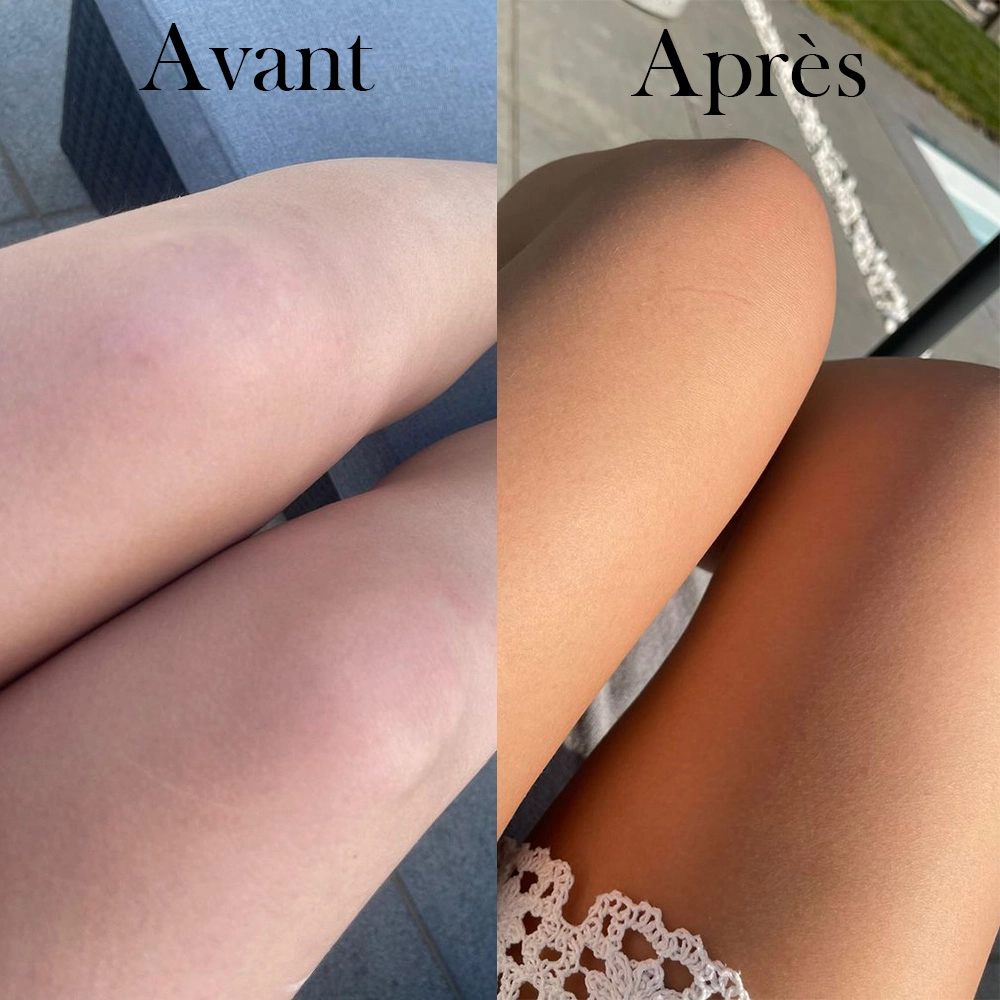 Ysalie - Photos Avant/Après d'une cure de complément alimentaire Idéal Soleil, jambes bien bronzées